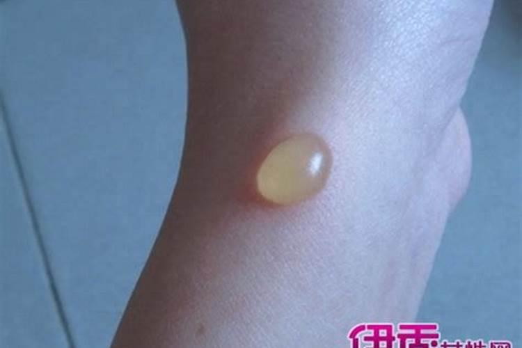 水产养殖中用什么氮肥最好