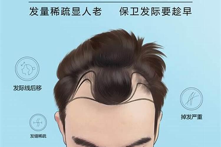 种瓜用什么肥料好