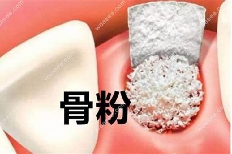果树常用磷肥有哪些