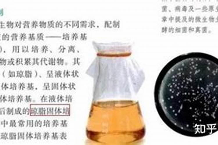幸福树怎么养长得好