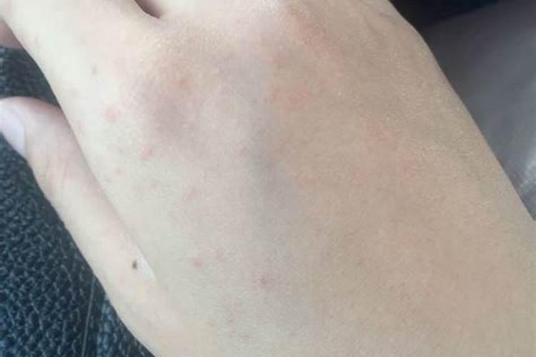 请教这是什么病？果子青一块,红一块,表皮硬硬的,抠开里面硬